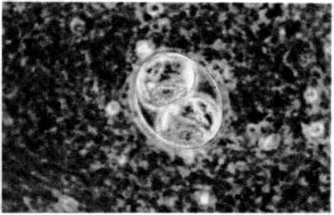  Phyllophallus! Bu Tekrarlayan Yükselmelerle İç Parazitin Sürünmesinin Gizemi