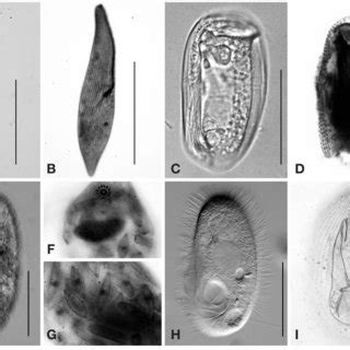  Wongella!  A Ciliate with Striking Stripes that Lives in Coastal Waters