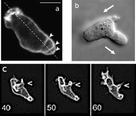  Dictyostelium Discoideum: Bu Şaşırtıcı Tek Hücreli Birlikte Yaşamak İçin Nasıl Bir Yol Çiziyor?